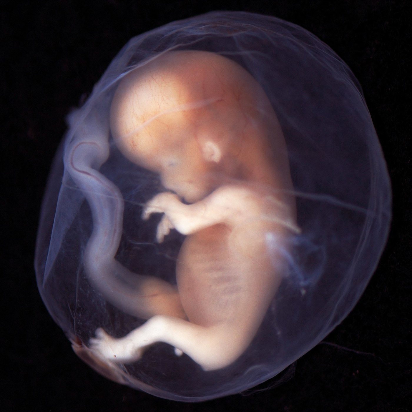 11. Lisette ten Haaf over de opmerkelijke juridische status van het embryo