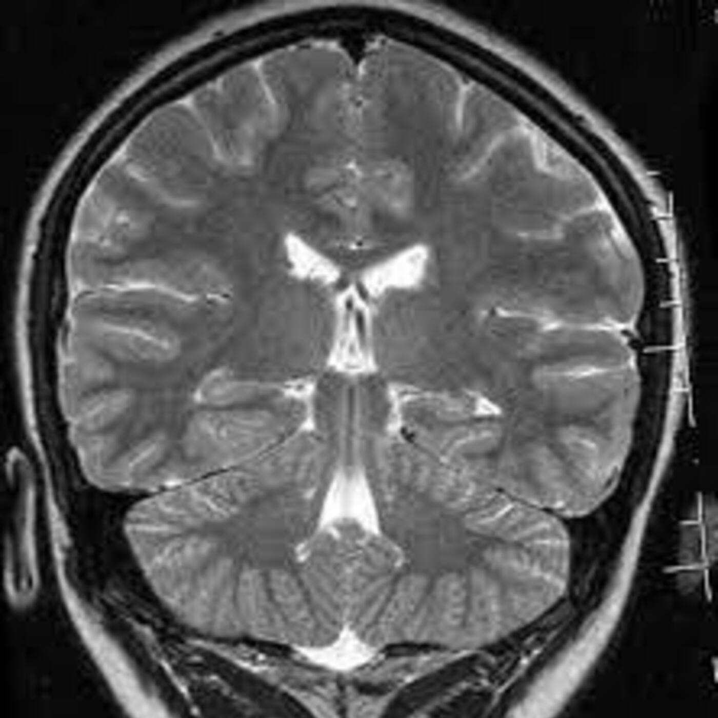 AI for climate modeling, Deepfakes are here, Boston Dynamics in a fight