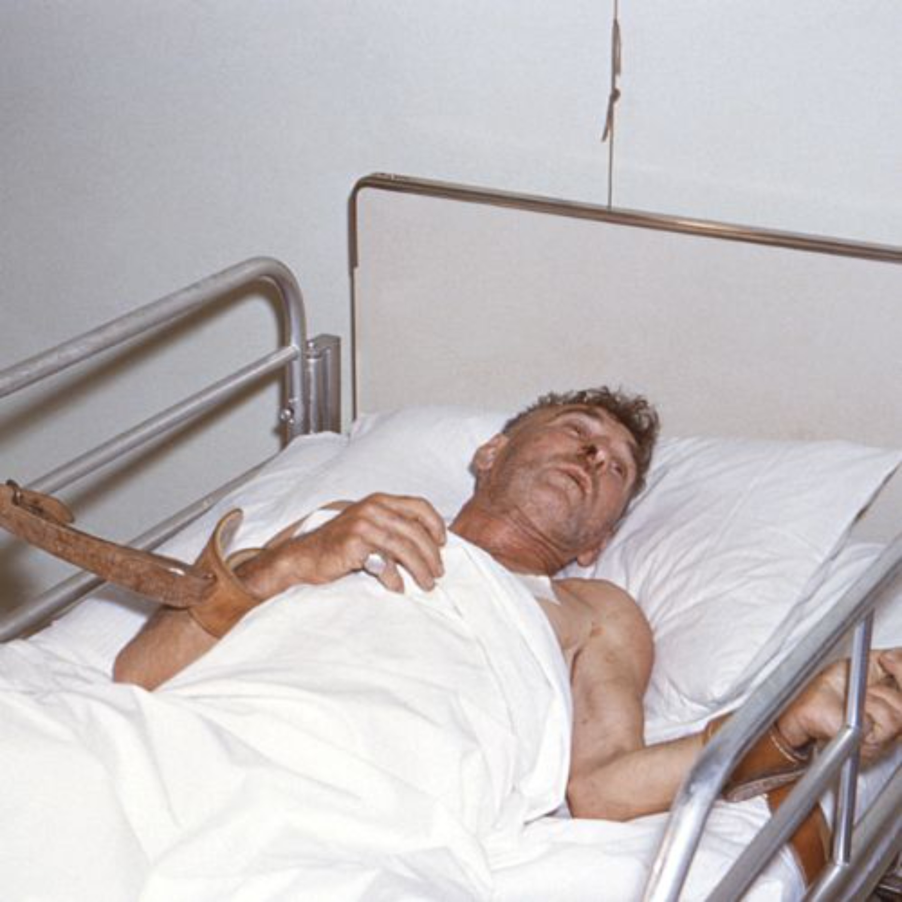 Human Rabies Cases: How It Kills and Who Survived