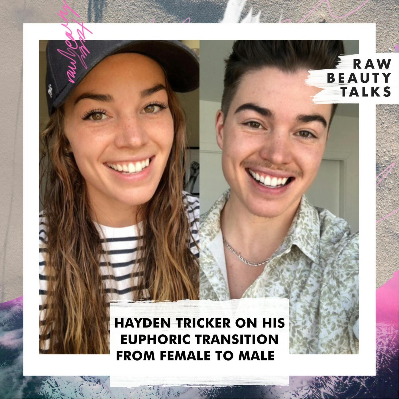 Hayden Tricker on His Euphoric Transition from Female to Male episode artwork