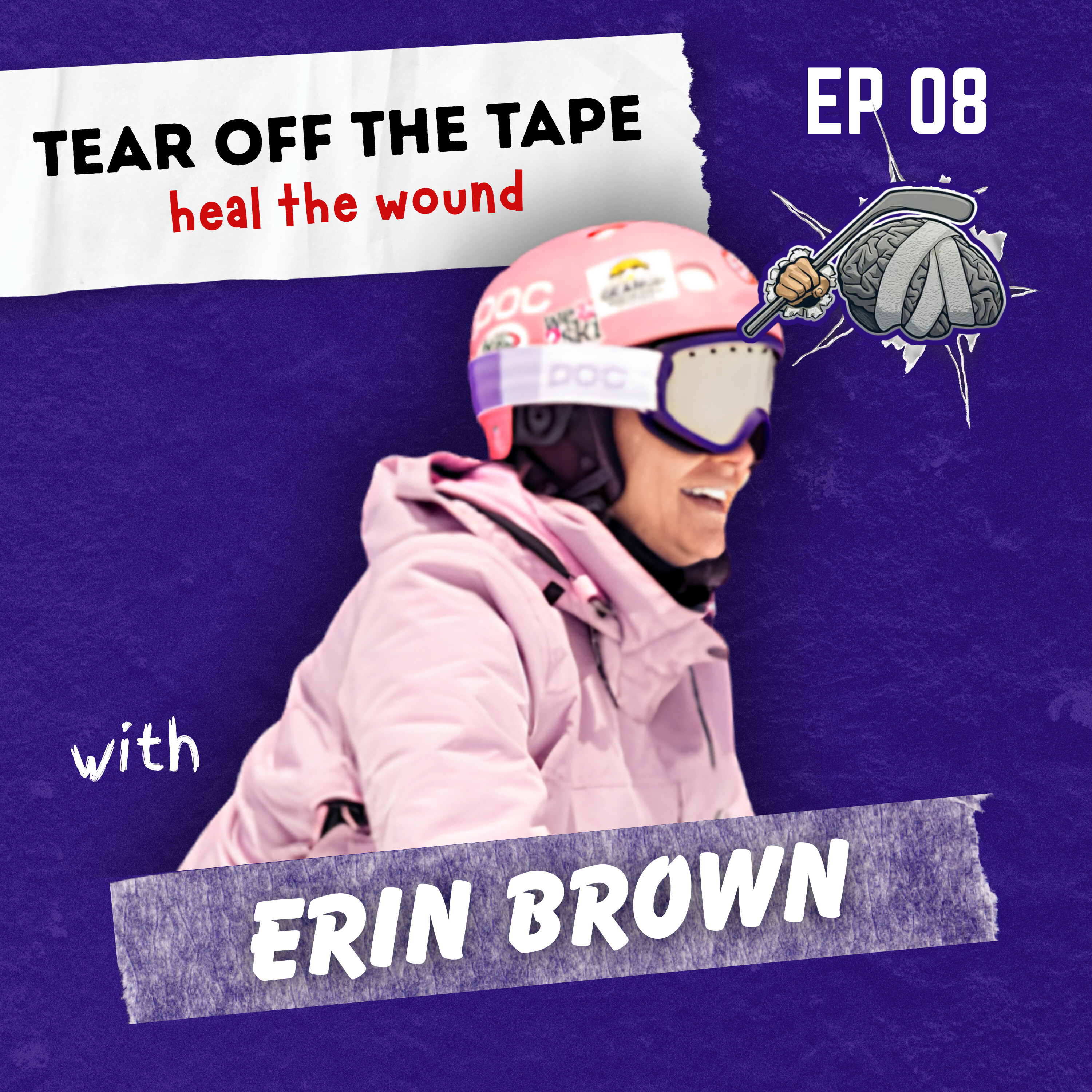 Broken Barbie: Erin’s Journey from Bullying to Amputation and Beyond