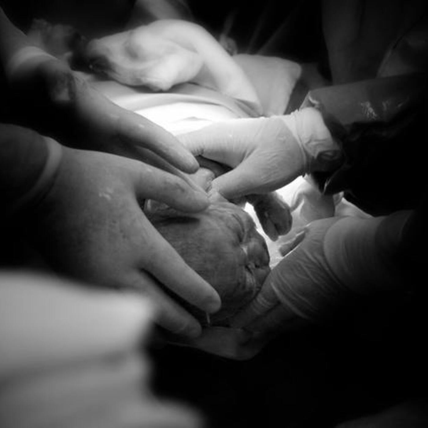 Ep. 48 Gentle Cesarean